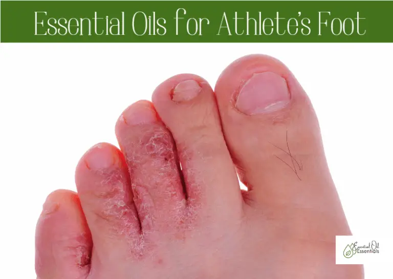 6 Best Essential Oils for Athlete’s Foot in 2022