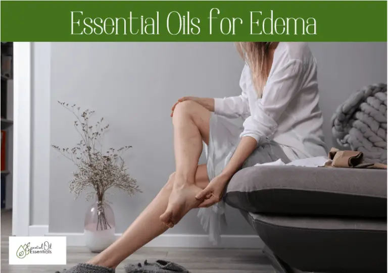 essential oils for edema