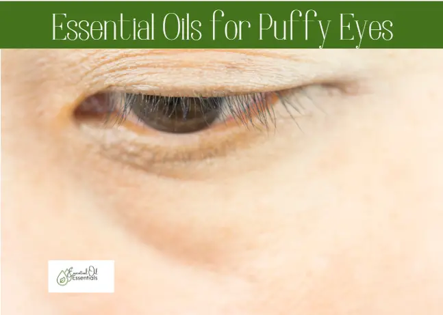 9 Best Essential Oils for Puffy Eyes in 2022